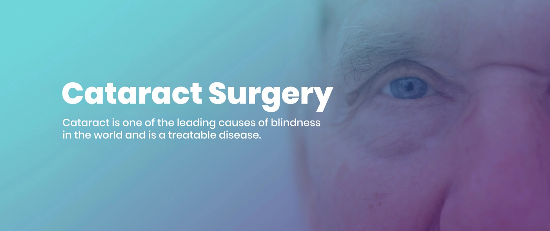 Cataract Surgery