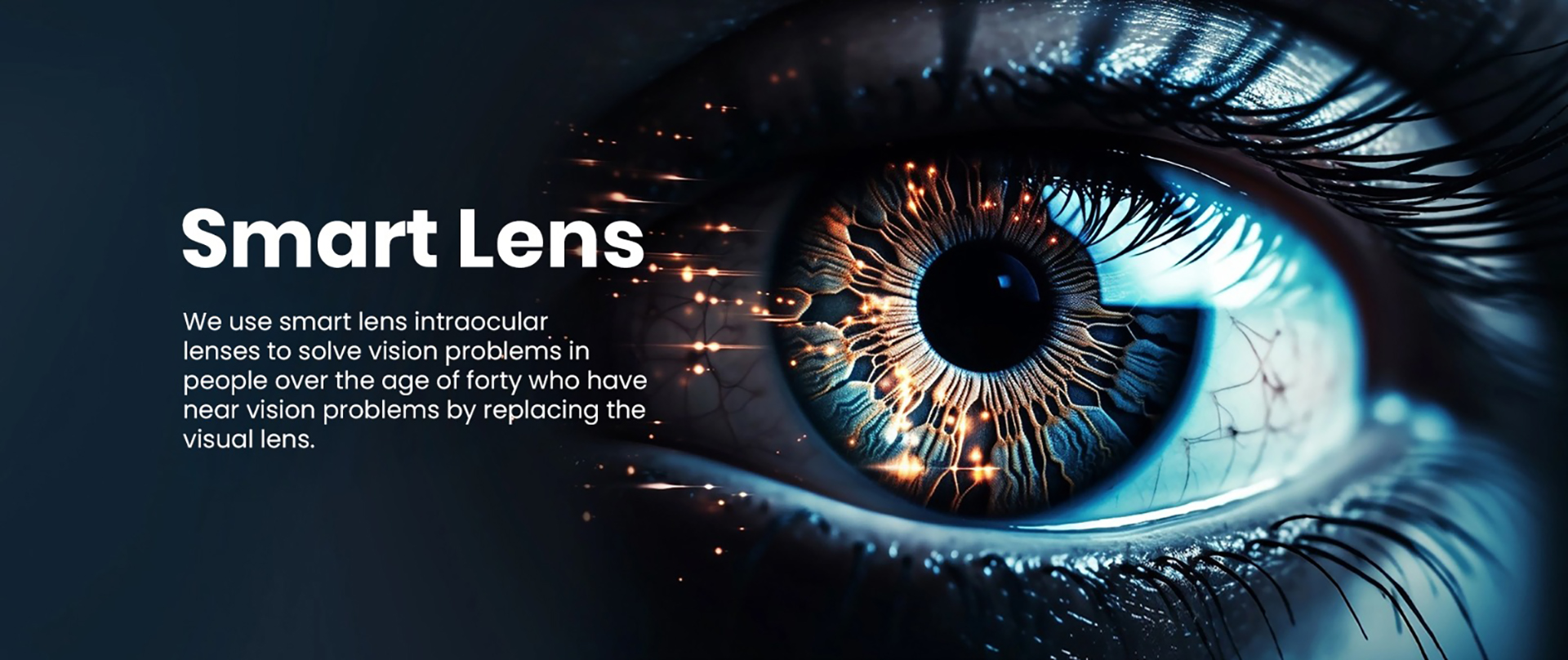 Premium Intraocular Lens (IOL)